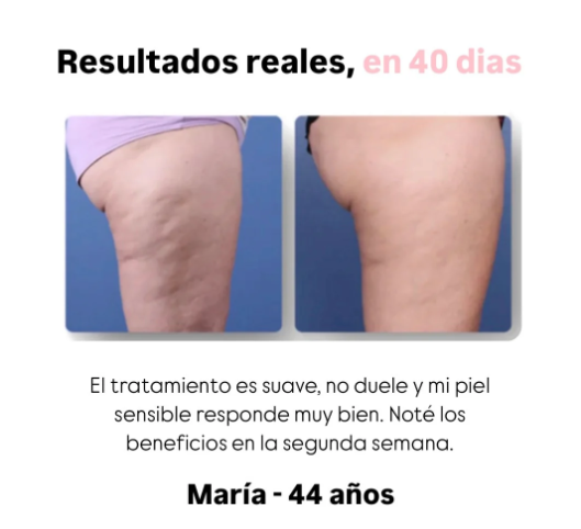 Masajeador anticelulítico Shaverr™
