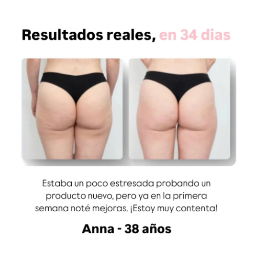 Masajeador anticelulítico Shaverr™