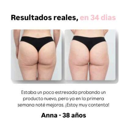 Masajeador anticelulítico Shaverr™